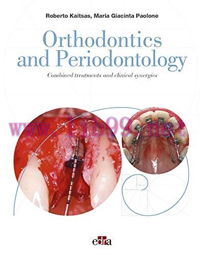 [AME]Orthodontics and Periodontology: Combined treatments and clinical synergies (azw3+epub+Con...