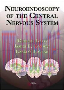 [AME]Neuroendoscopy of the Central Nervous System