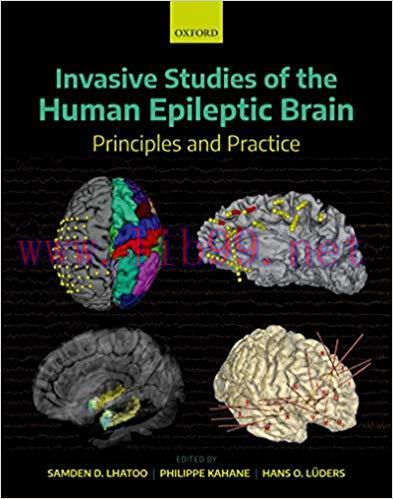 [PDF]Invasive Studies of the Human Epileptic Brain: Principles and Practice