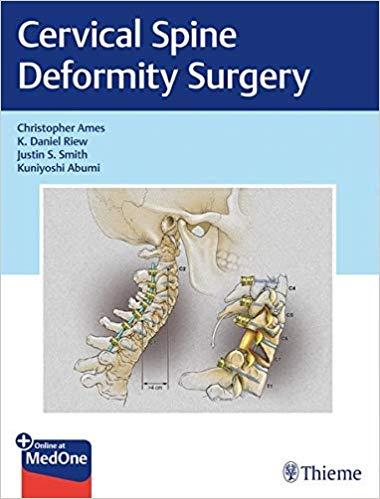 Cervical Spine Deformity Surgery