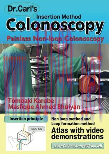 [AME]Dr. Carl's Colonoscopy insertion method: Painless Non-loop Colonoscopy (AZW 3 + EPUB + Con...