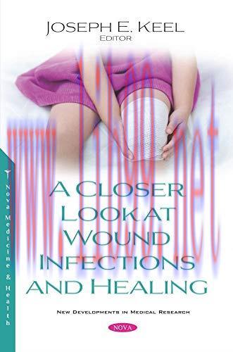 [AME]A Closer Look at Wound Infections and Healing (New Developments in Medical Research) (Orig...