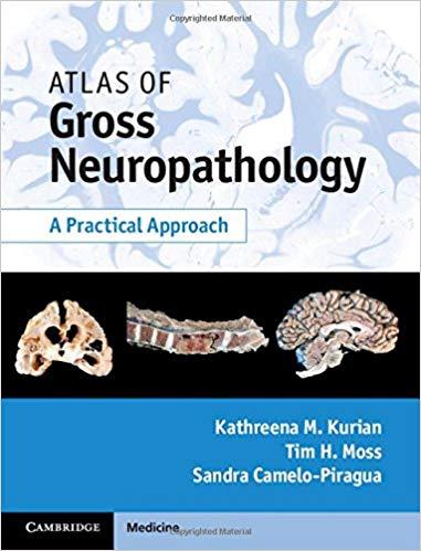 Atlas of Gross Neuropathology - A Practical Approach