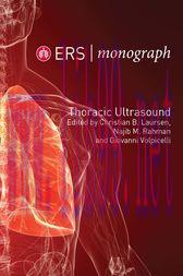 [AME]ERS Monograph 79: Thoracic Ultrasound (EPUB)