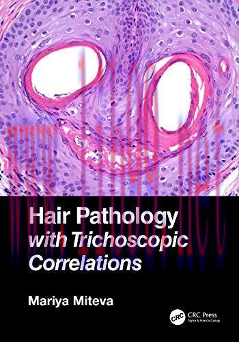 [AME]Hair Pathology with Trichoscopic Correlations (Original PDF)
