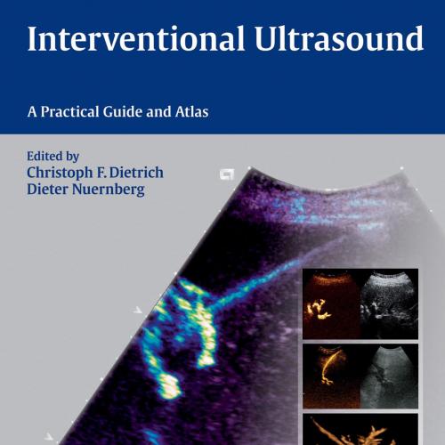 Interventional Ultrasound A Practical Guide and Atlas, 1E