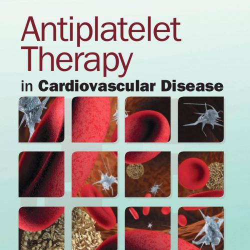Antiplatelet Therapy in Cardiovascular Disease