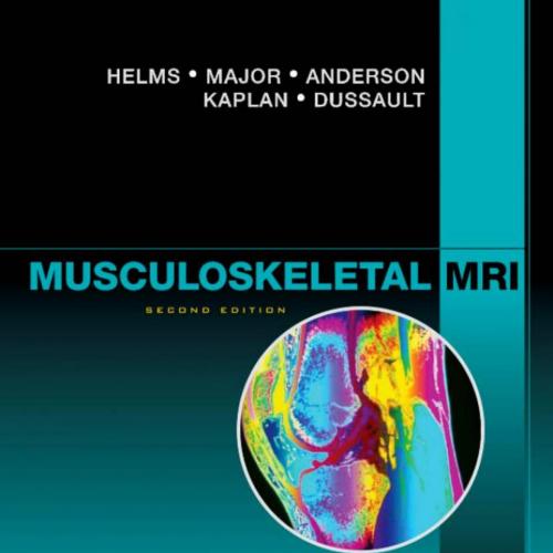 Musculoskeletal MRI,2nd Edition