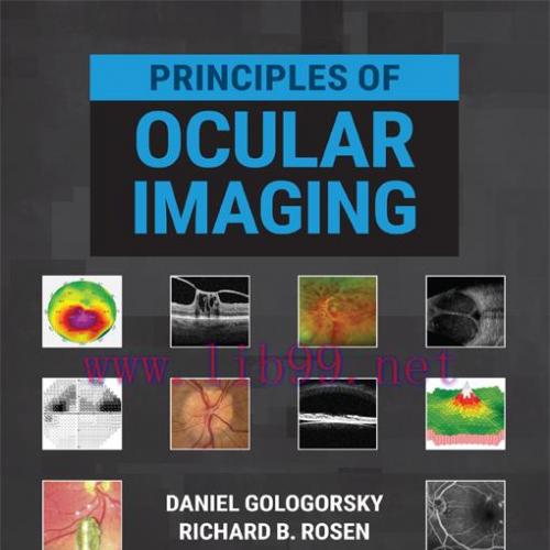 [AME]Principles of Ocular Imaging (EPUB)