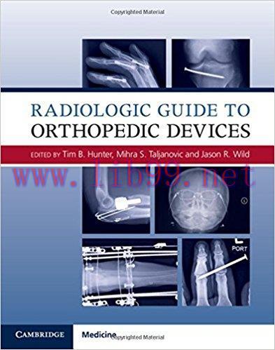 [AME]Radiologic Guide to Orthopedic Devices, 1e (ORIGINAL PDF from_ Publisher)