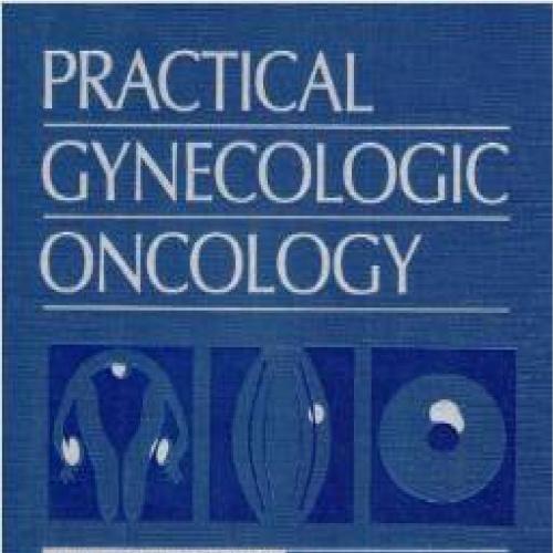 Practical Gynecologic Oncology (4th Edition)