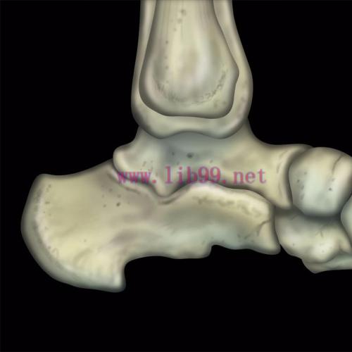 [AME]MRIOnline MRI Mastery Series: Ankle 2017 (CME VIDEOS)