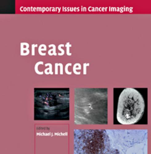Breast Cancer (Contemporary Issues in Cancer Imaging)
