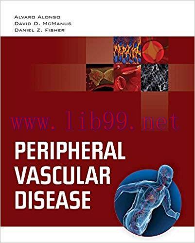[PDF]Peripheral Vascular Disease
