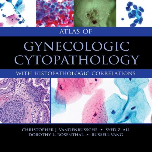 Atlas of Gynecologic Cytopathology With Histopathologic Correlations - PhD, Christopher J. Vand...