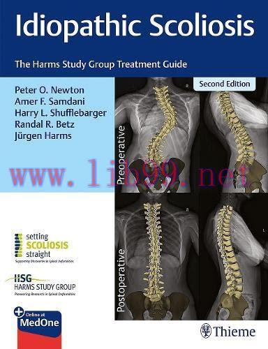 [AME]Idiopathic Scoliosis: The Harms Study Group Treatment Guide, 2nd edition (Original PDF)