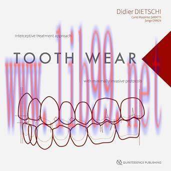 [AME]Tooth Wear: Interceptive Treatment Approach With Minimally Invasive Protocols (Original PD...