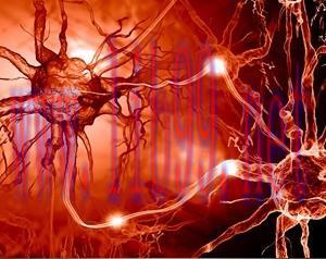 [AME]Comprehensive Review of Electrodiagnostic Medicine and Neuromuscular Disorders 2014 (CME V...