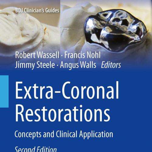 Extra-Coronal Restorations