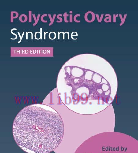 [AME]Polycystic Ovary Syndrome, 3rd edition (Original PDF)