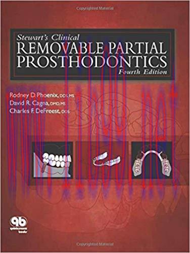 [PDF]Stewart&rsquo;s Clinical Removable Partial Prosthodontics 4th Edition