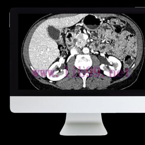 [AME]ARRS Gastrointestinal Imaging Online Course 2019 (CME VIDEOS)