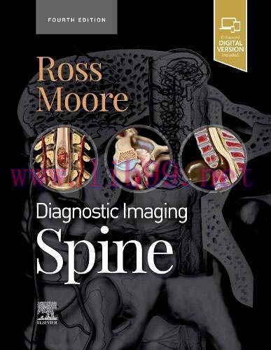 [AME]Diagnostic Imaging: Spine, 4th Edition (Epub + Converted PDF)