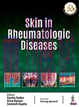 [PDF]Skin In Rheumatologic Diseases