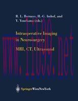 [PDF]Intraoperative Imaging in Neurosurgery: MRI, CT, Ultrasound