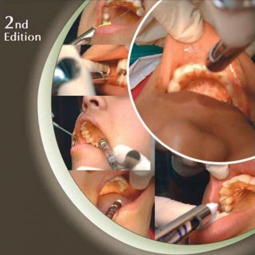 Manual of Local Anesthesia in Dentistry 2nd Edition