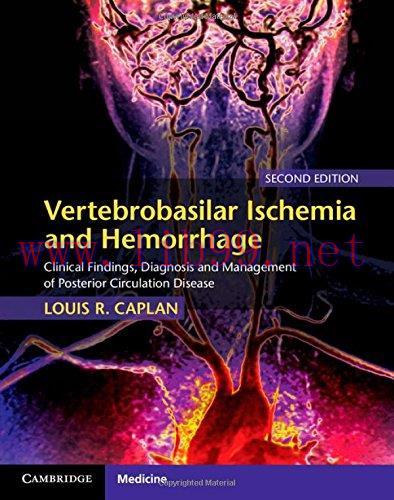 [FOX-Ebook]Vertebrobasilar Ischemia and Hemorrhage, 2nd Edition