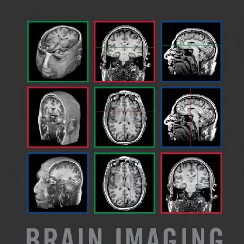 Brain Imaging A Guide for Clinicians