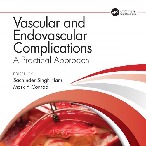 Vascular and Endovascular Complications