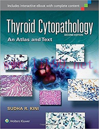 [PDF]Thyroid Cytopathology - An Atlas and Text+CHM版