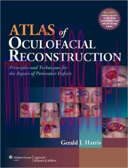 [AME]Atlas of Oculofacial Reconstruction: Principles and Techniques for the Repair of Periocula...