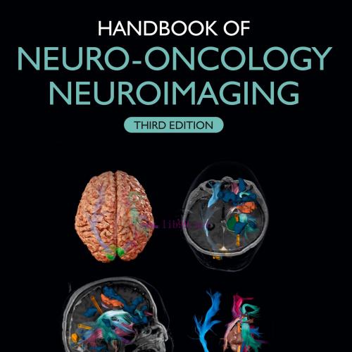 [AME]Handbook of Neuro-Oncology Neuroimaging, 3rd Edition (EPUB)