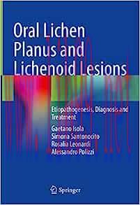 [AME]Oral Lichen Planus and Lichenoid Lesions: Etiopathogenesis, Diagnosis and Treatment (EPUB)