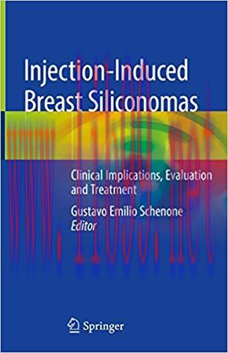 [AME]Injection-Induced Breast Siliconomas: Clinical Implications, Evaluation and Treatment 1st ...