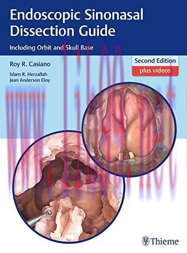 [AME]Endoscopic Sinonasal Dissection Guide: Including Orbit and Skull Base, 2nd Edition (PDF)