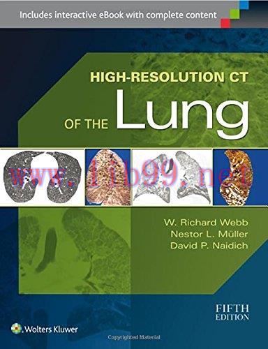 [AME]High-Resolution CT of the Lung (EPUB)