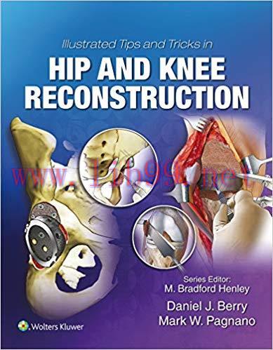 (PDF)Illustrated Tips and Tricks in Hip and Knee Reconstructive and Replacement Surgery First E...