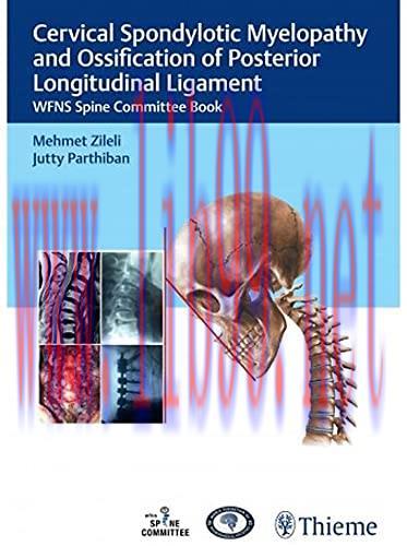 [AME]Cervical Spondylotic Myelopathy and Ossification of Posterior Longitudinal Ligament (Origi...