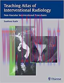 [PDF]Teaching Manual of Color Duplex Sonography (Matthias Hofer)