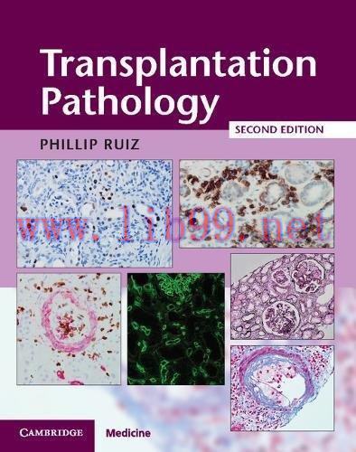 [AME]Transplantation Pathology (PDF)