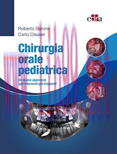 [AME]Chirurgia orale pediatrica: Un nuovo approccio agli interventi pi&ugrave; frequenti (Italian Edit...