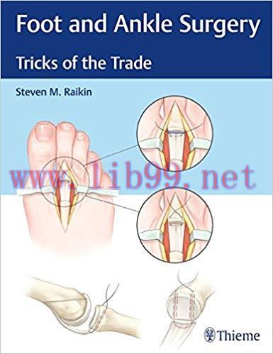 [PDF]Foot and Ankle Surgery Tricks of the Trade