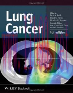 [AME]Lung Cancer, 4th Edition (Original PDF)