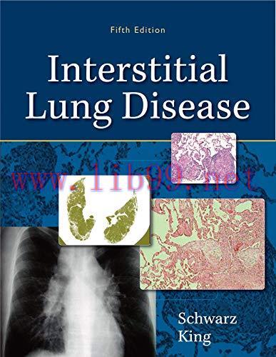 [AME]Interstitial Lung Disease, 5th Edition (Original PDF)