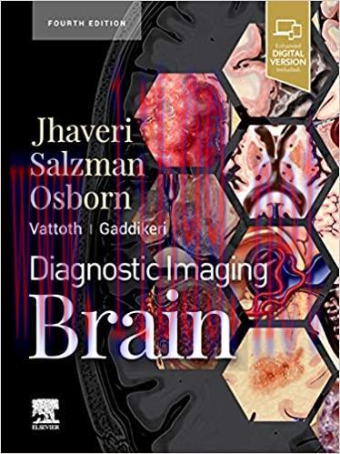 [EPUB]Diagnostic Imaging: Brain E-Book 4th Edition