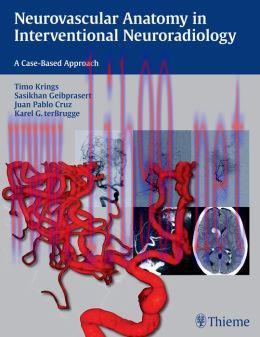 [AME]Neurovascular Anatomy in Interventional Neuroradiology: A Case-Based Approach